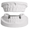 LOWER CANINES WITH BAR