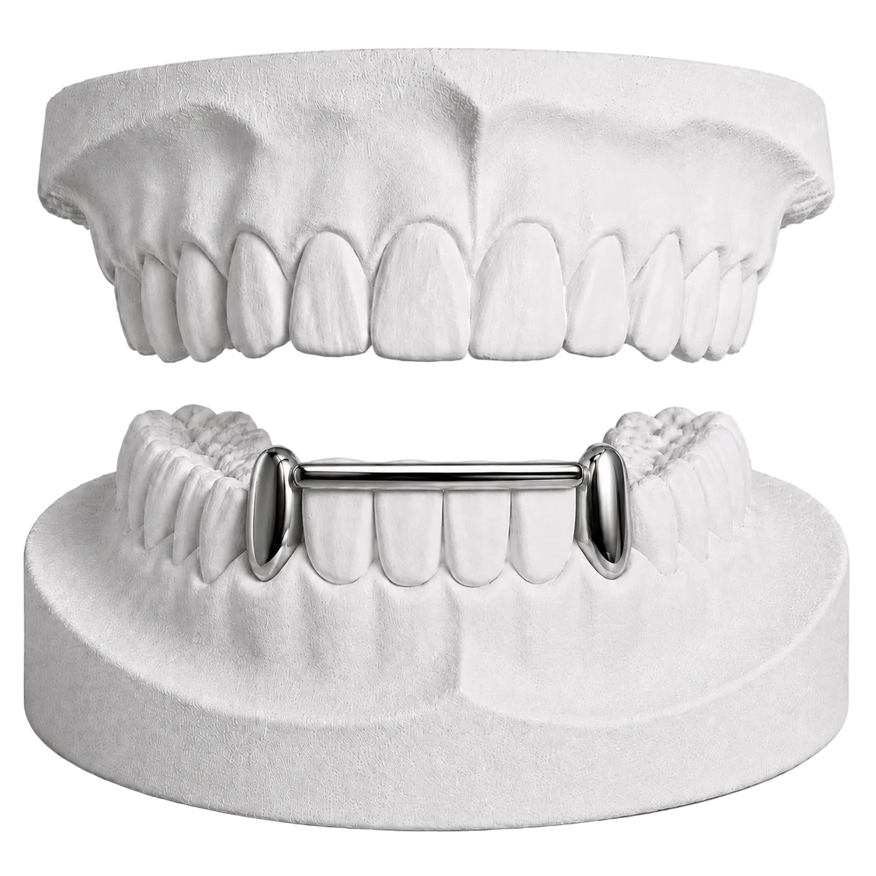 LOWER CANINES WITH BAR