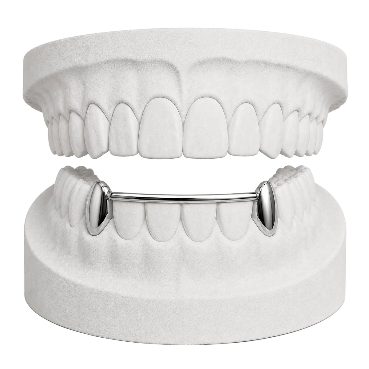 LOWER CANINES WITH BAR