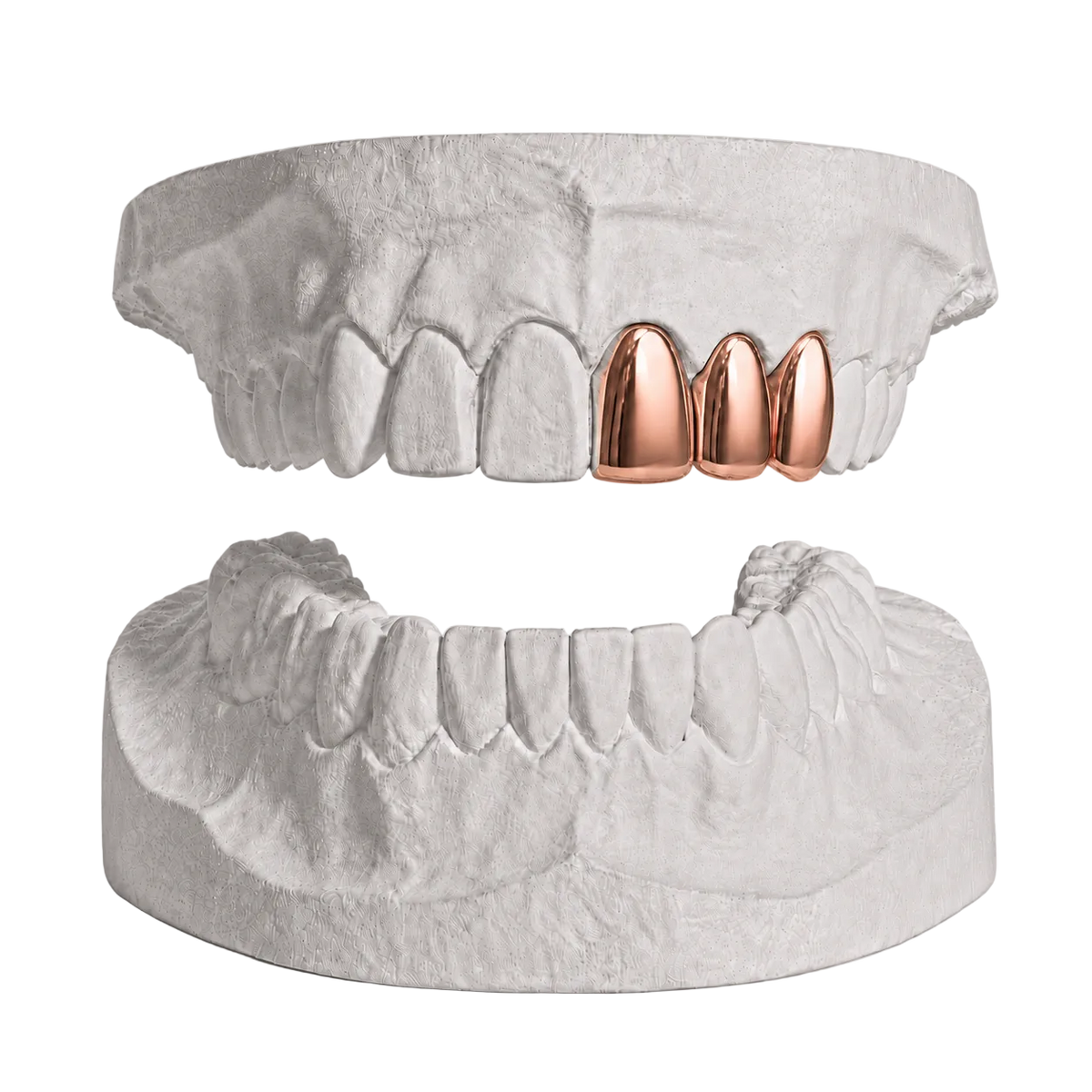 ANY 3 TEETH