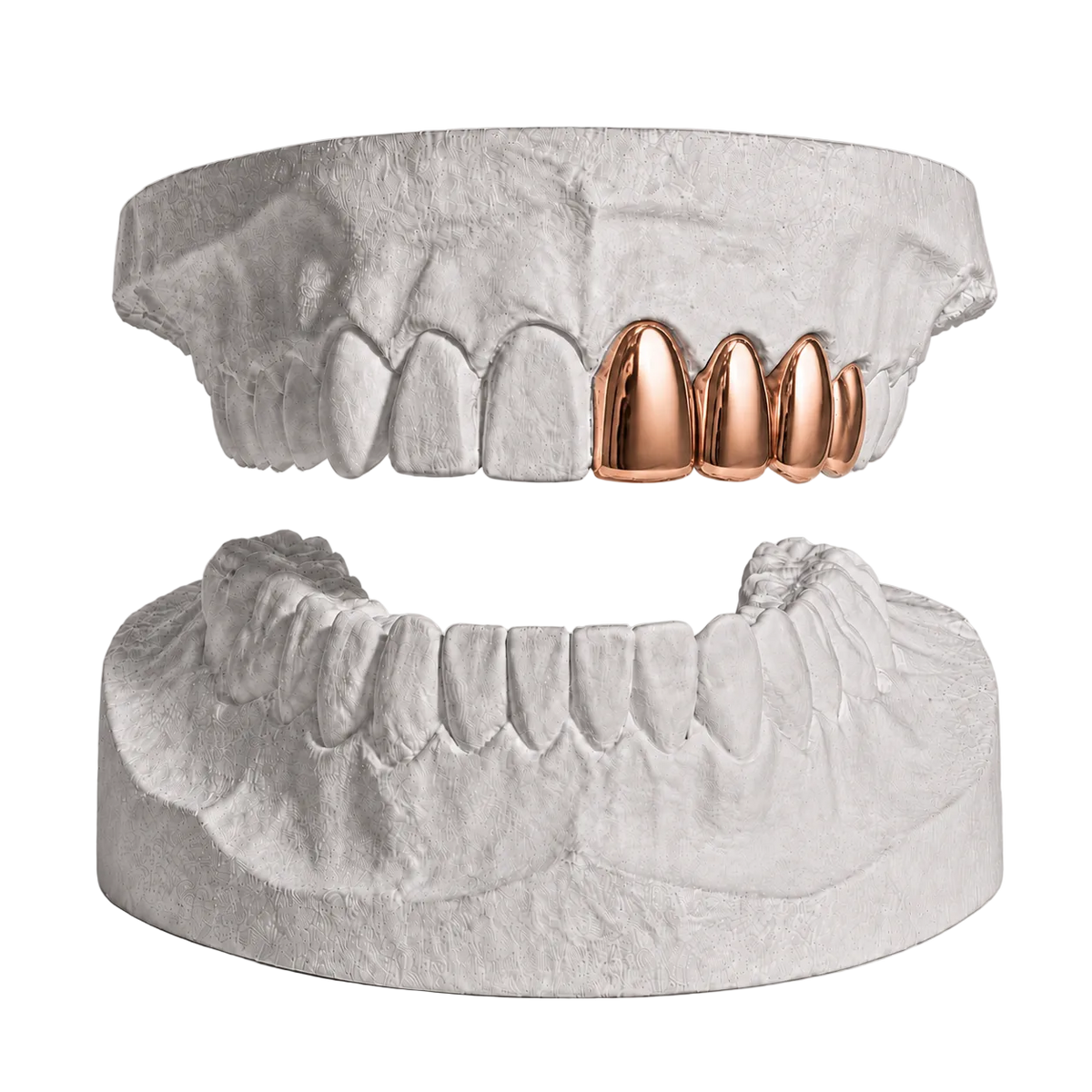 ANY 4 TEETH