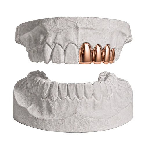 ANY 4 TEETH
