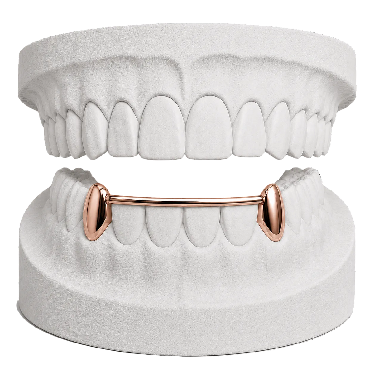 LOWER CANINES WITH BAR