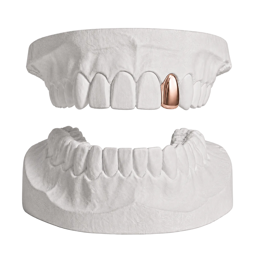 ANY 1 TOOTH