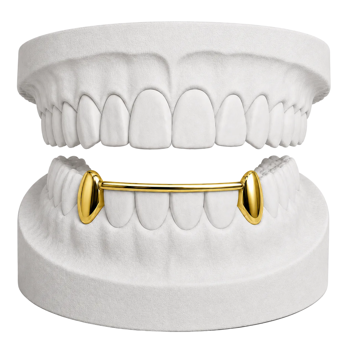 LOWER CANINES WITH BAR